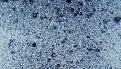 microplastica-placenta-umana-feto