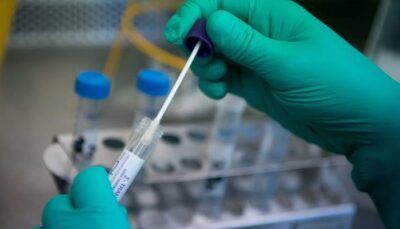 coronavirus-mistero-casi-ritorno