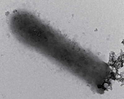 sedimenti a 120° con microrganismi