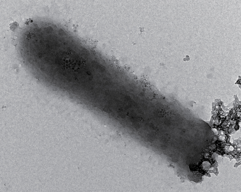 sedimenti a 120° con microrganismi