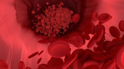 Covid-19 proteina spike sistema vascolare