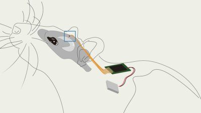 sistema neuroelettronico