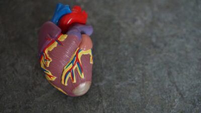 arterie (2)