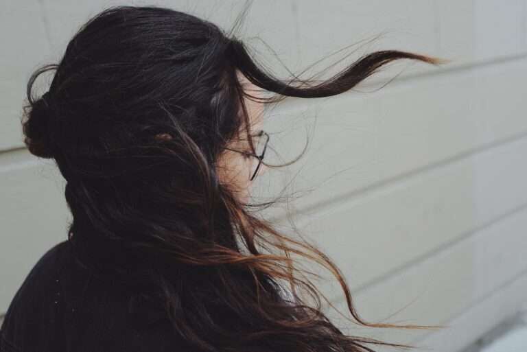 alopecia (2)