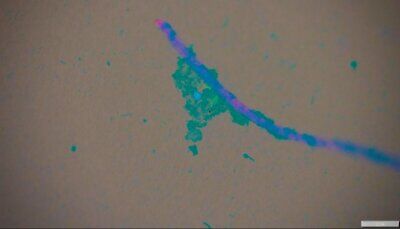 microplastica-parassiti-particelle-mare