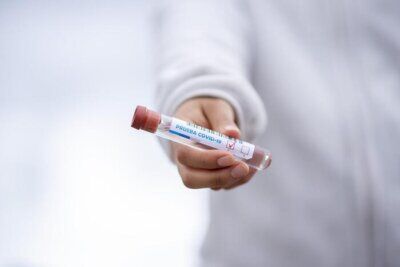covid-19 test sistema immunitario