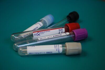 carenza sangue piastrine