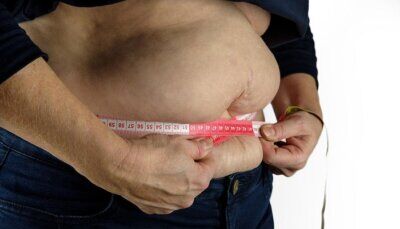 obesità-salute-diverse-tipologie