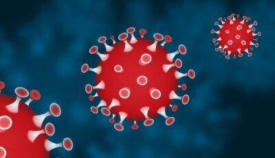 covid-19 lupus infezione
