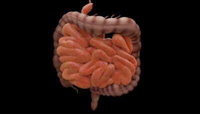 sindrome-del-colon-irritabile-gravita