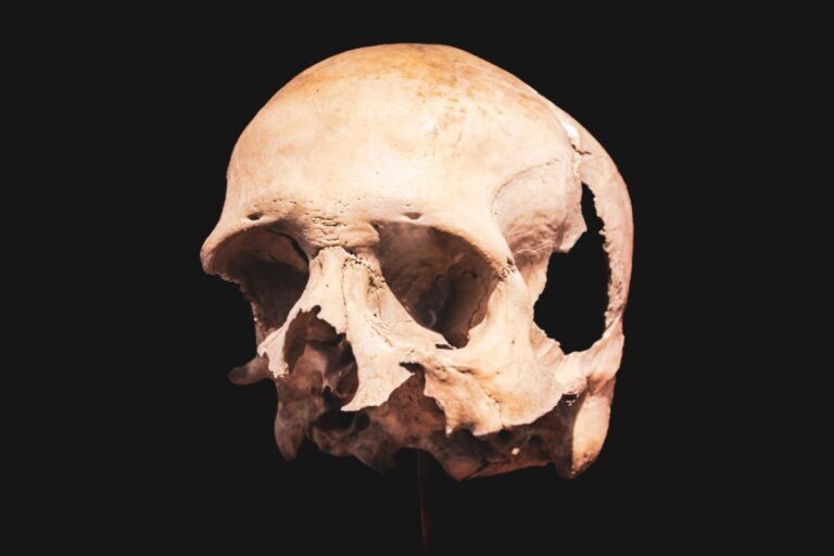 cranio