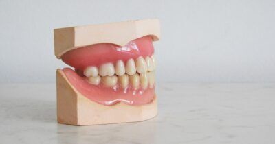 alzheimer-igiene-dentale-morbo