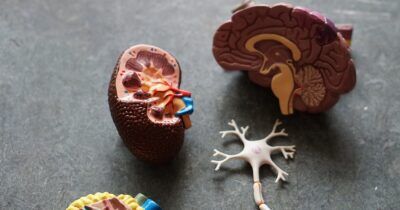 parkinson-esercizio-fisico-intenso
