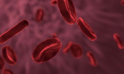alzheimer sangue