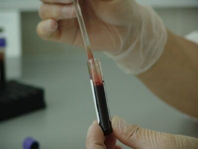 cancro giovani problema emergente