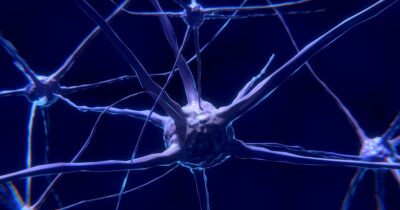 parkinson-diagnosi-anticipo-neuoroni