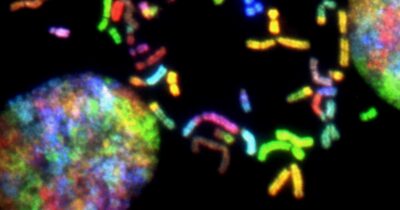 alzheimer-proteina-proteggere-malattia