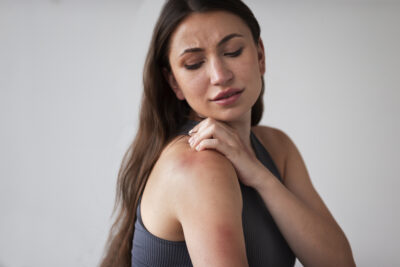 eczema cura batteri pelle