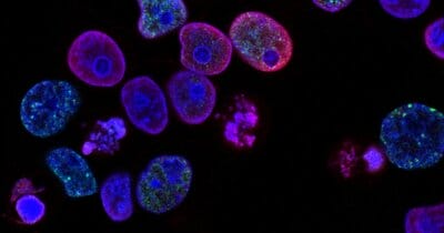 cancro-sostanze-chimiche-crescita