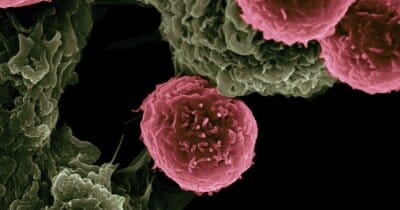 cancro-proteine-blocco-peptide