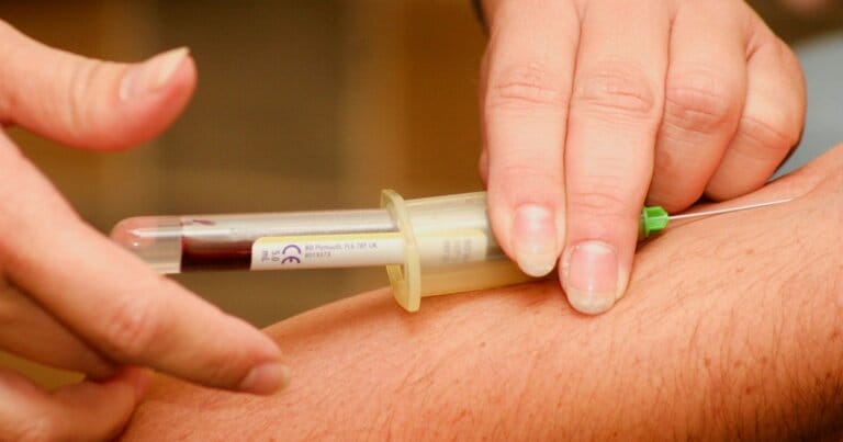 demenza-test-sangue-diagnosi