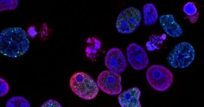 cannabis-combattere-cancro-pelle