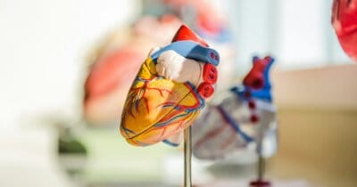 plastica-arterie-ostruite-salute