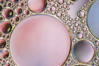 Parkinson cellule staminali cure