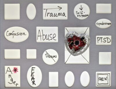 cura PTSD stimolazione cerebrale