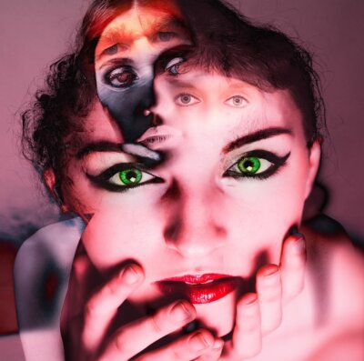 cellule gliali depressione schizofrenia