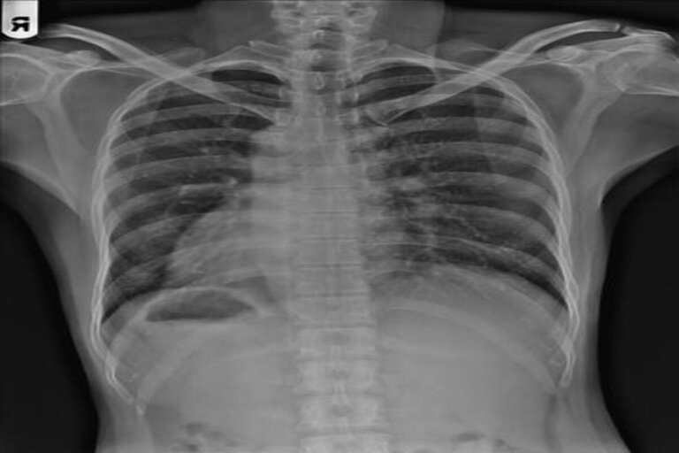 situs inversus organi