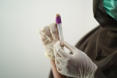 sangue artificiale universale
