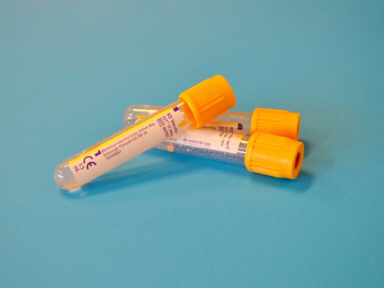 Un esame del sangue può rilevare il cancro fino a 3 anni prima dei sintomi