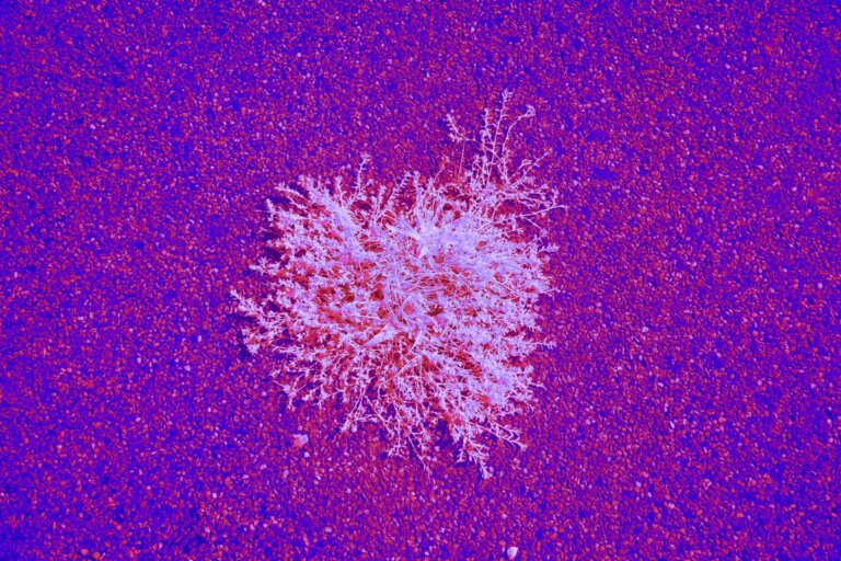 glioblastoma intervento dietetico
