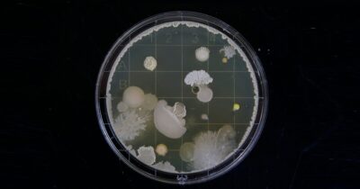 batteri-resistenza-antibiotici-neonati