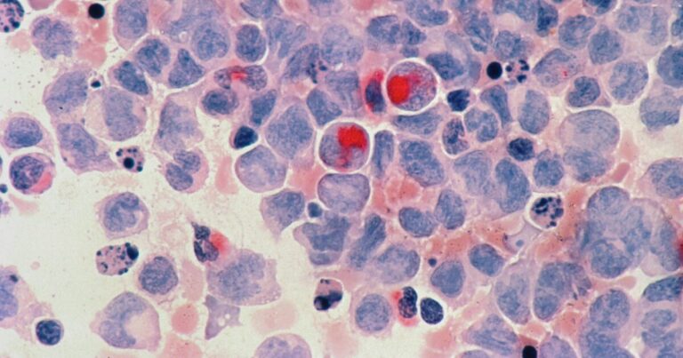 cancro-efficacia-vaccini-laboratorio