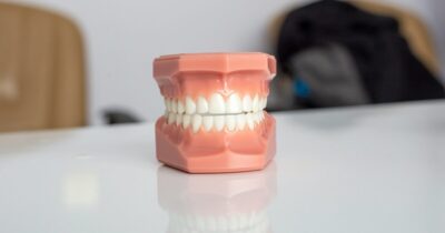 denti-trattamento-salute-smalto