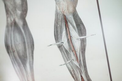 lesioni nervose risposta immunitaria