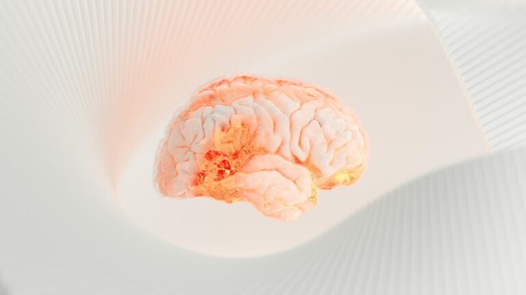 Alzheimer cervello