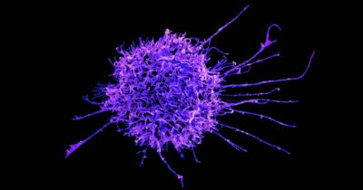 sistema-immunitario-ringiovanirlo-salute