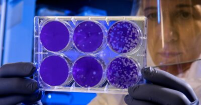 cancro-colon-virus-nuovo