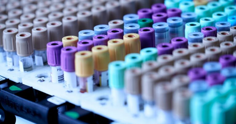 demenza-diagnosi-donne-test