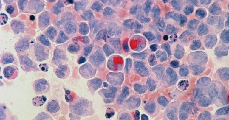 cancro-salute-prevenibile-tumori