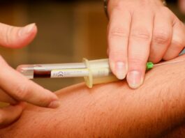 stress struttura sangue