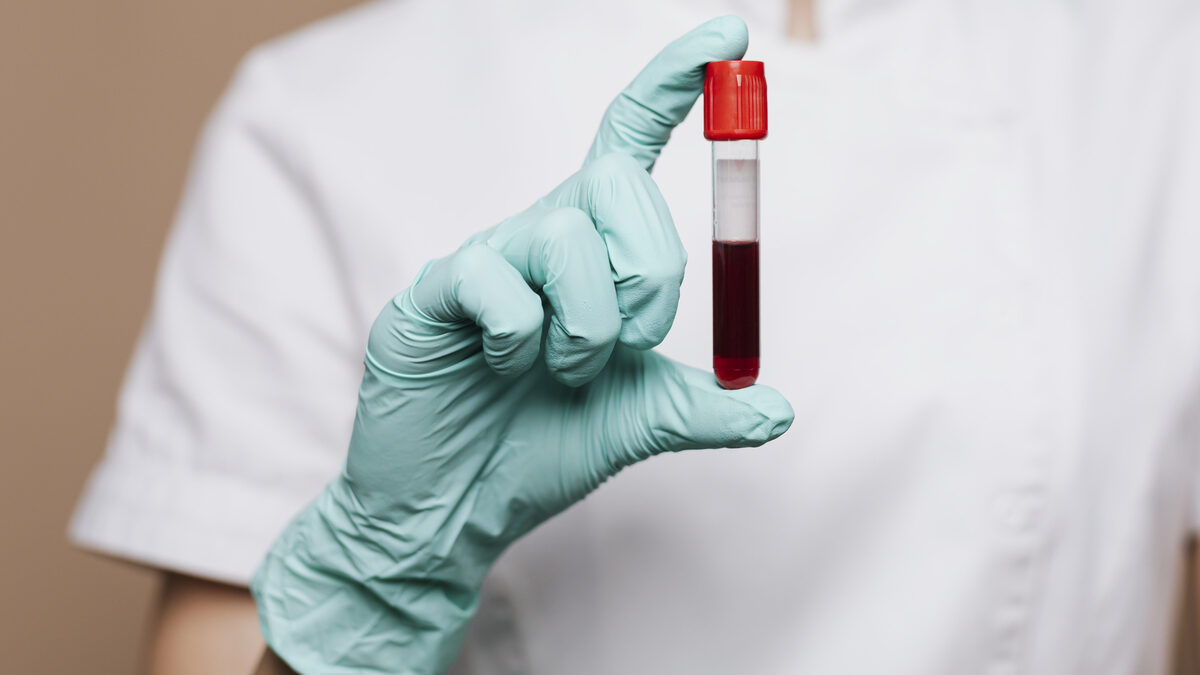 co2 sangue umano