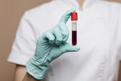co2 sangue umano